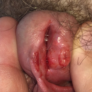 Another cut healing. 