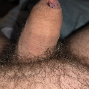 Glansectomy