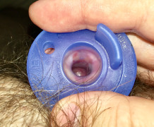 Trying a pacifier to see into my stretched meatus