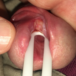 Open wide so everyone can see!