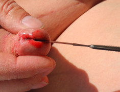 cut with some blood