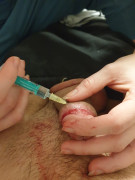 numbing