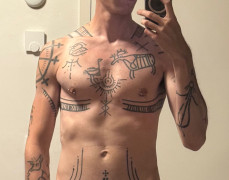 after 70/70cc silicone per pec