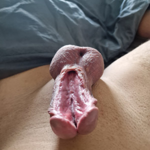 No Caption