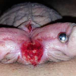 No Caption