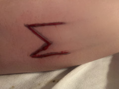 Scarification 