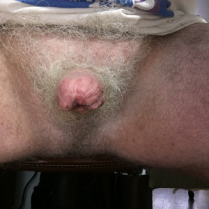 erect, end view