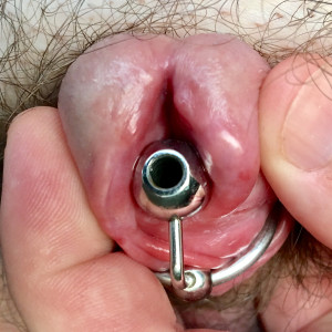 Hollow sound with ring, going deeper post meato. 