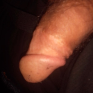 I circumcised myself one night when I was 25 and bored.