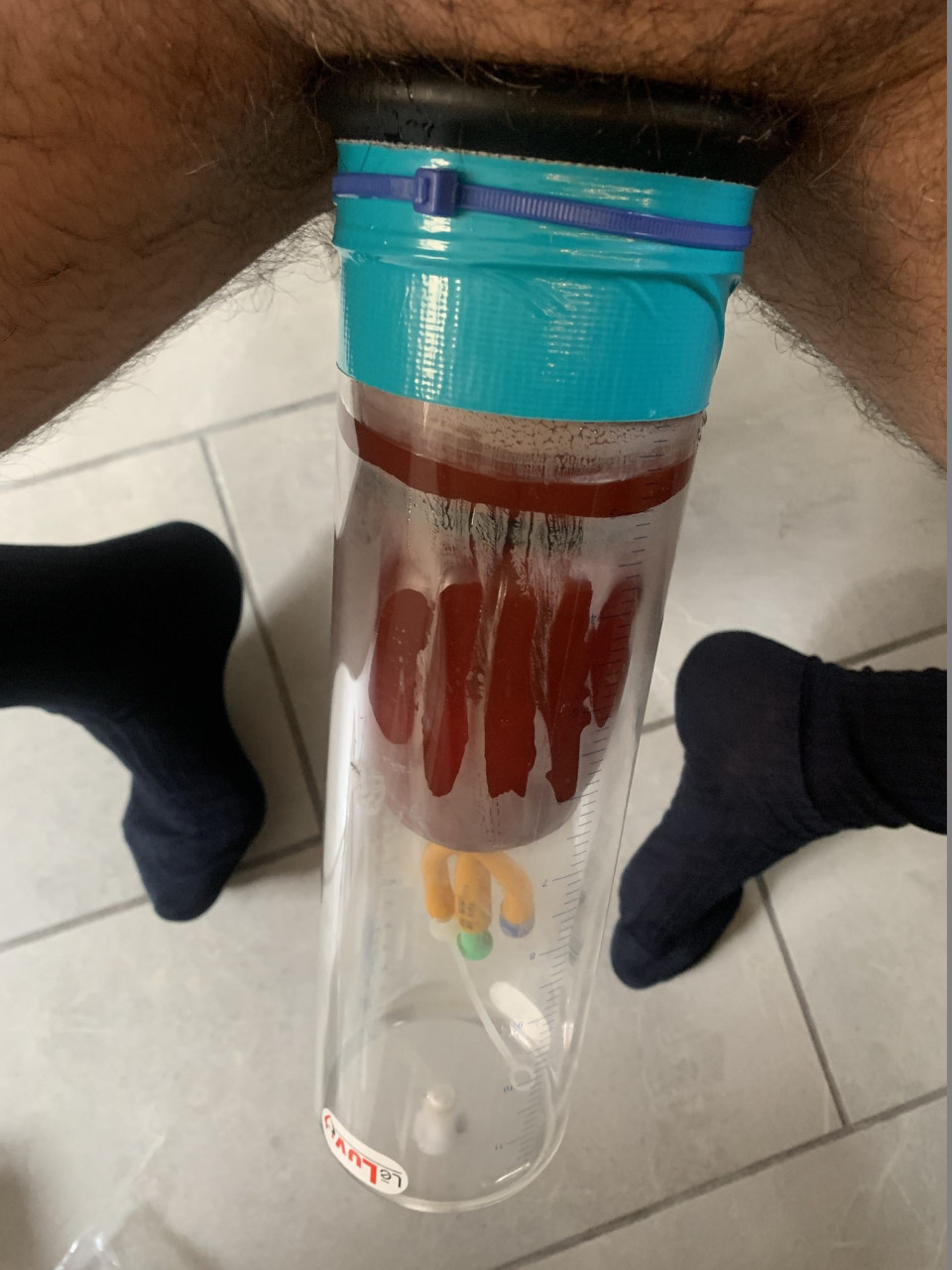 Pumping with silicon chastity, and 3-way catheter 