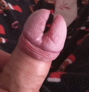 Si me dolió pero me gusta 