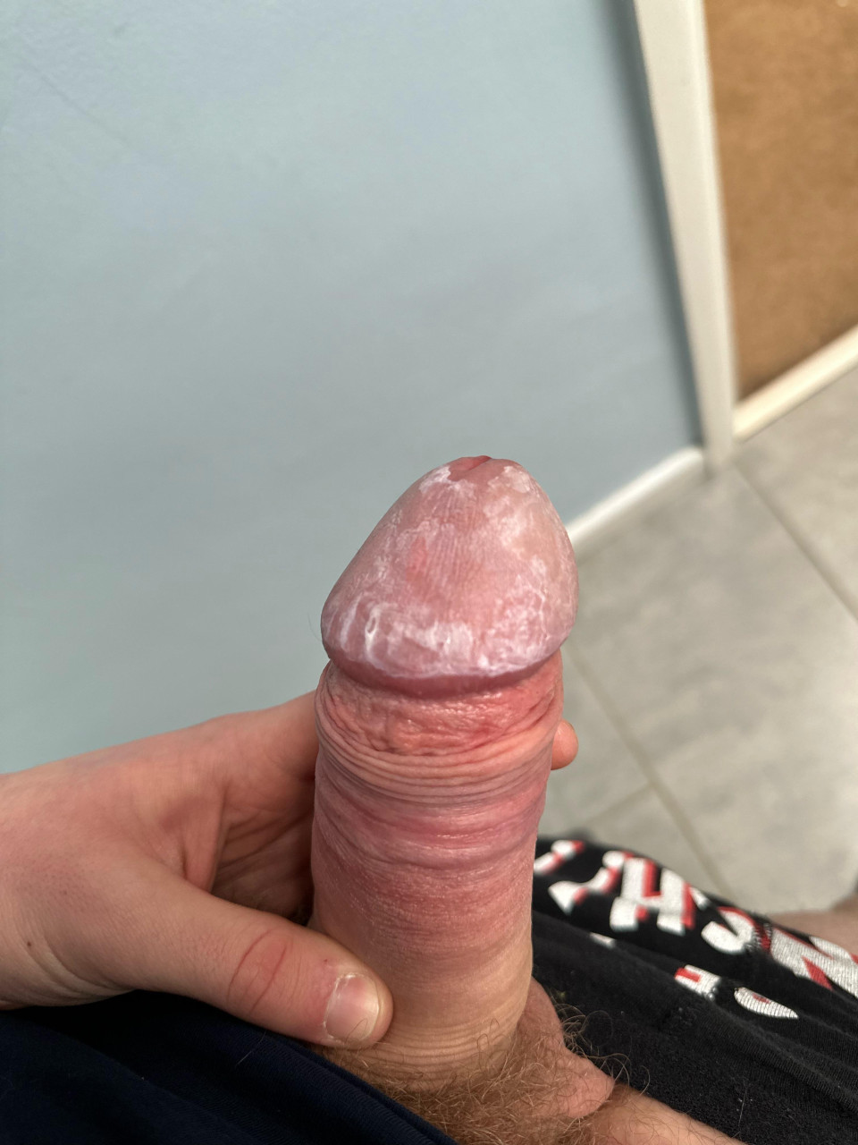 Verruca cream