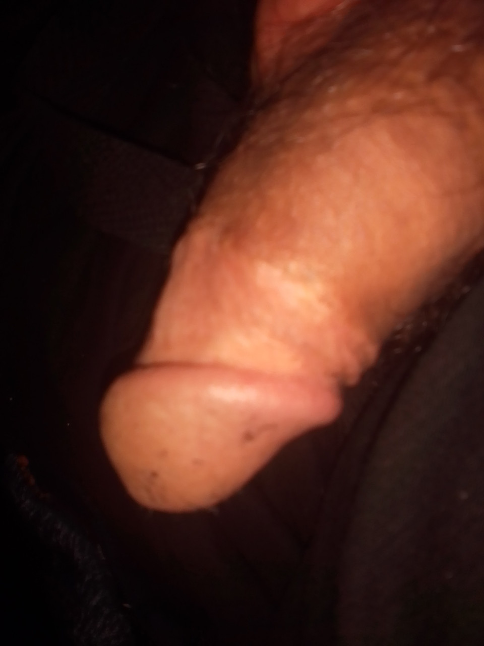 I circumcised myself one night when I was 25 and bored.