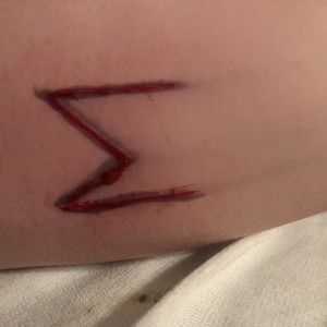 Scarification 