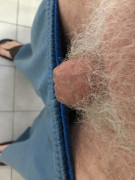 Flaccid. 10 weeks after glansectomy (and scrotectomy).