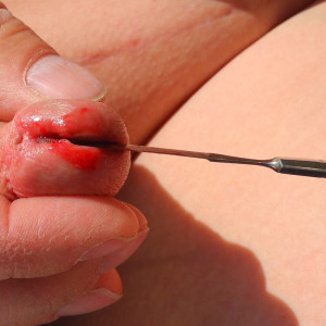 cut with some blood