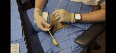 Anesthetic Injection