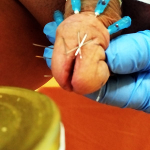 needle in cockhead