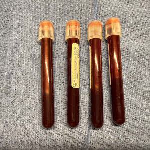 Samples Obtained From Penis
