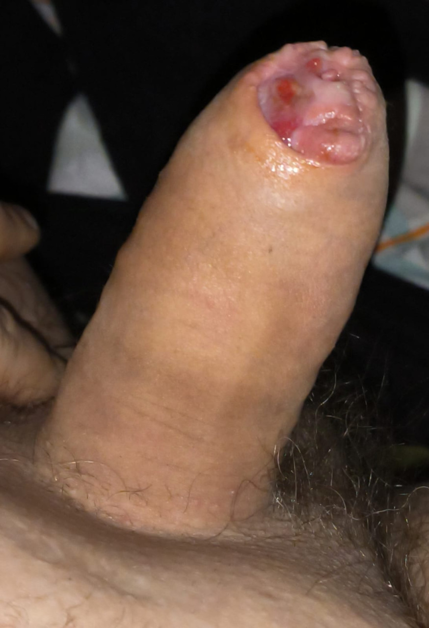 No Caption