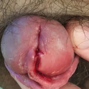 A view from above after PA removed. You almost wouldn’t know. 