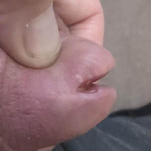 Bit more head