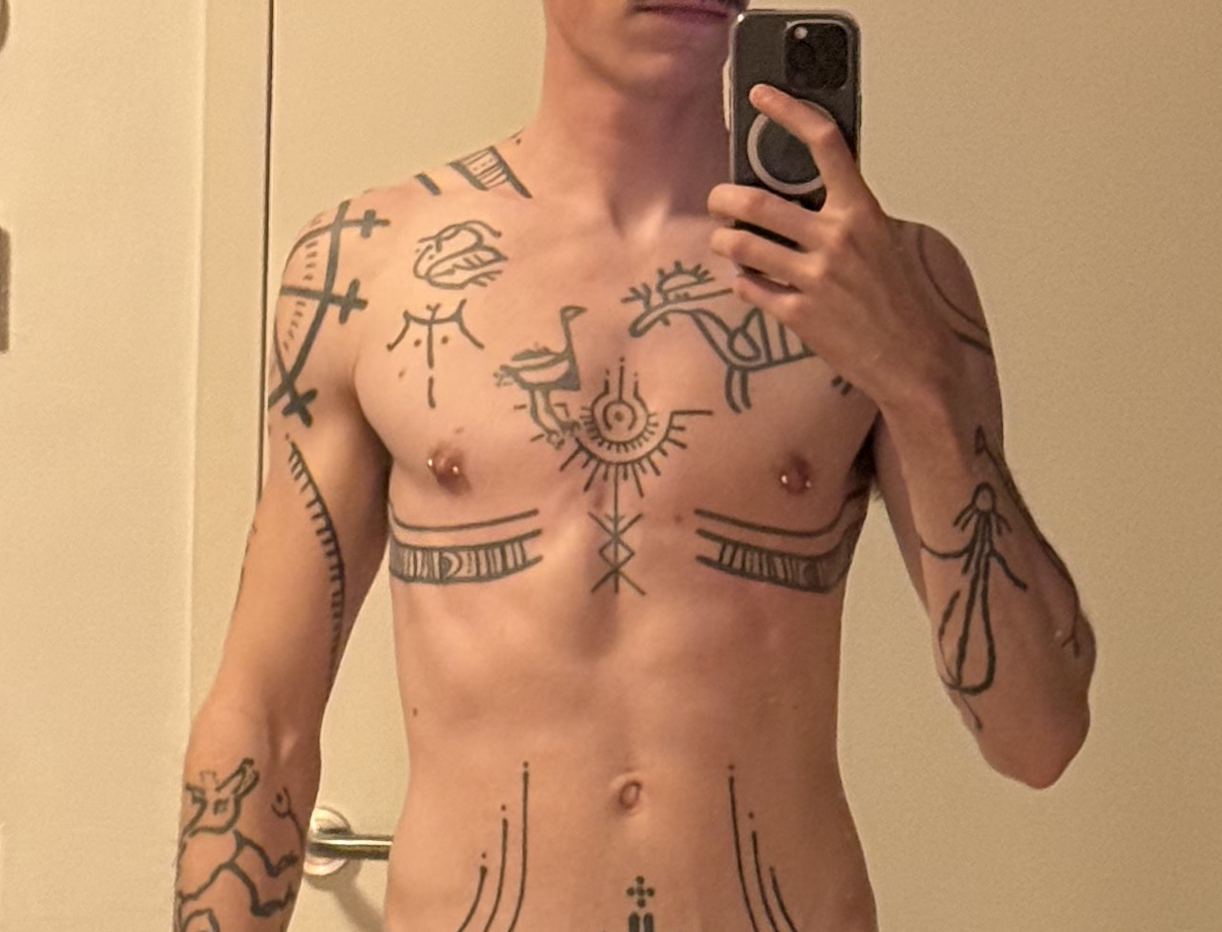 before pec filler
