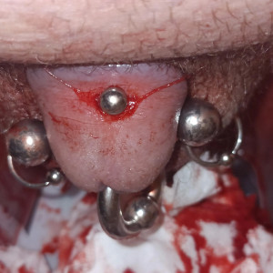 Self piercing apadravya,sorry for the blood took the pic right after I did it 