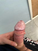 Verruca cream