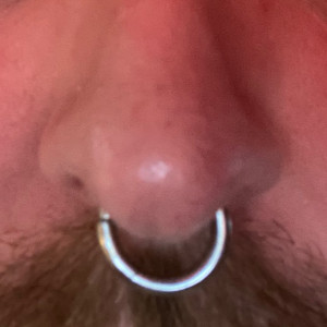 Septum @3,0mm