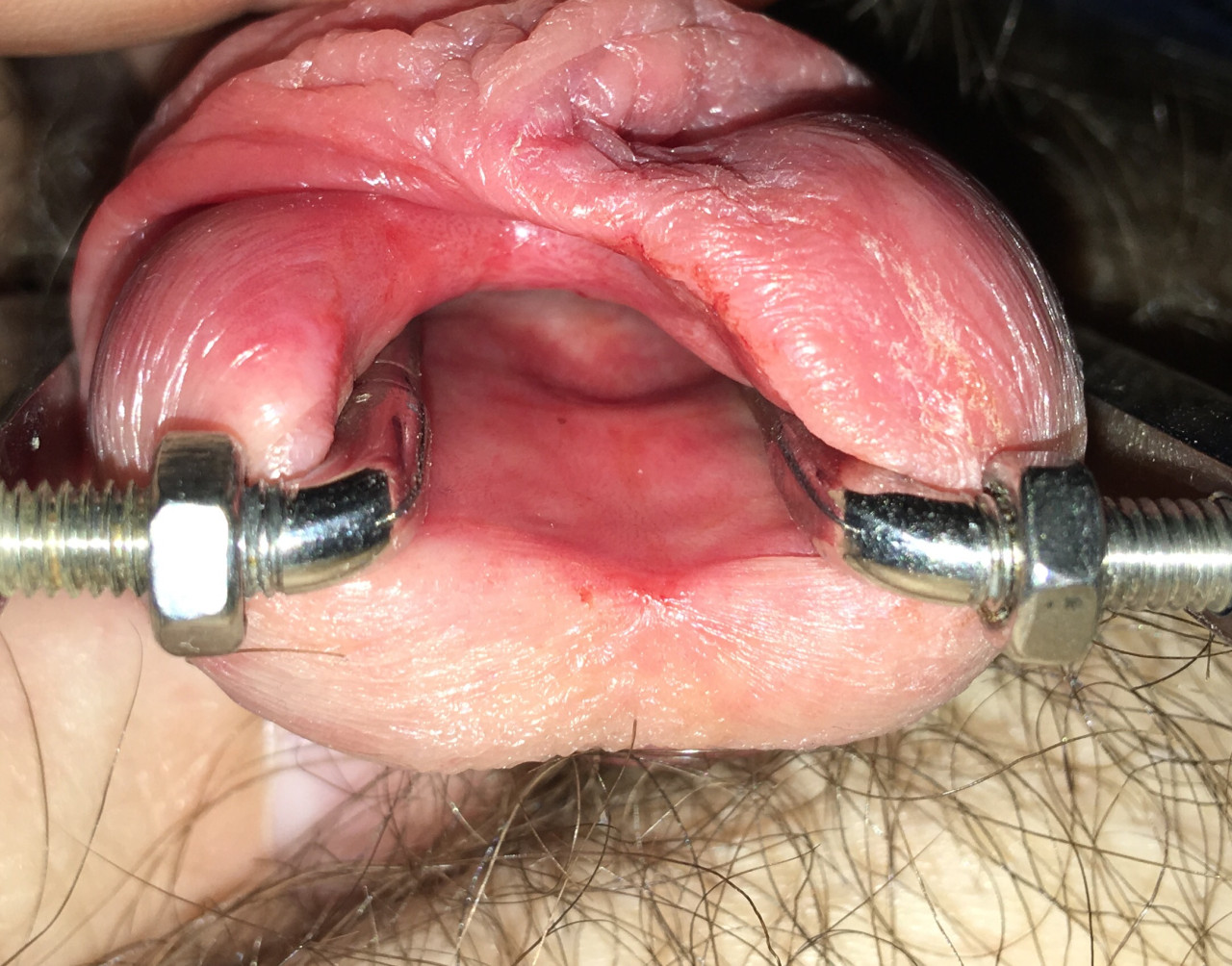 Open wide! No WIDER!