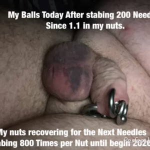 Summary Needle stabing 