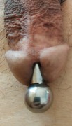 After frenulum resection