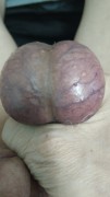 My  balls