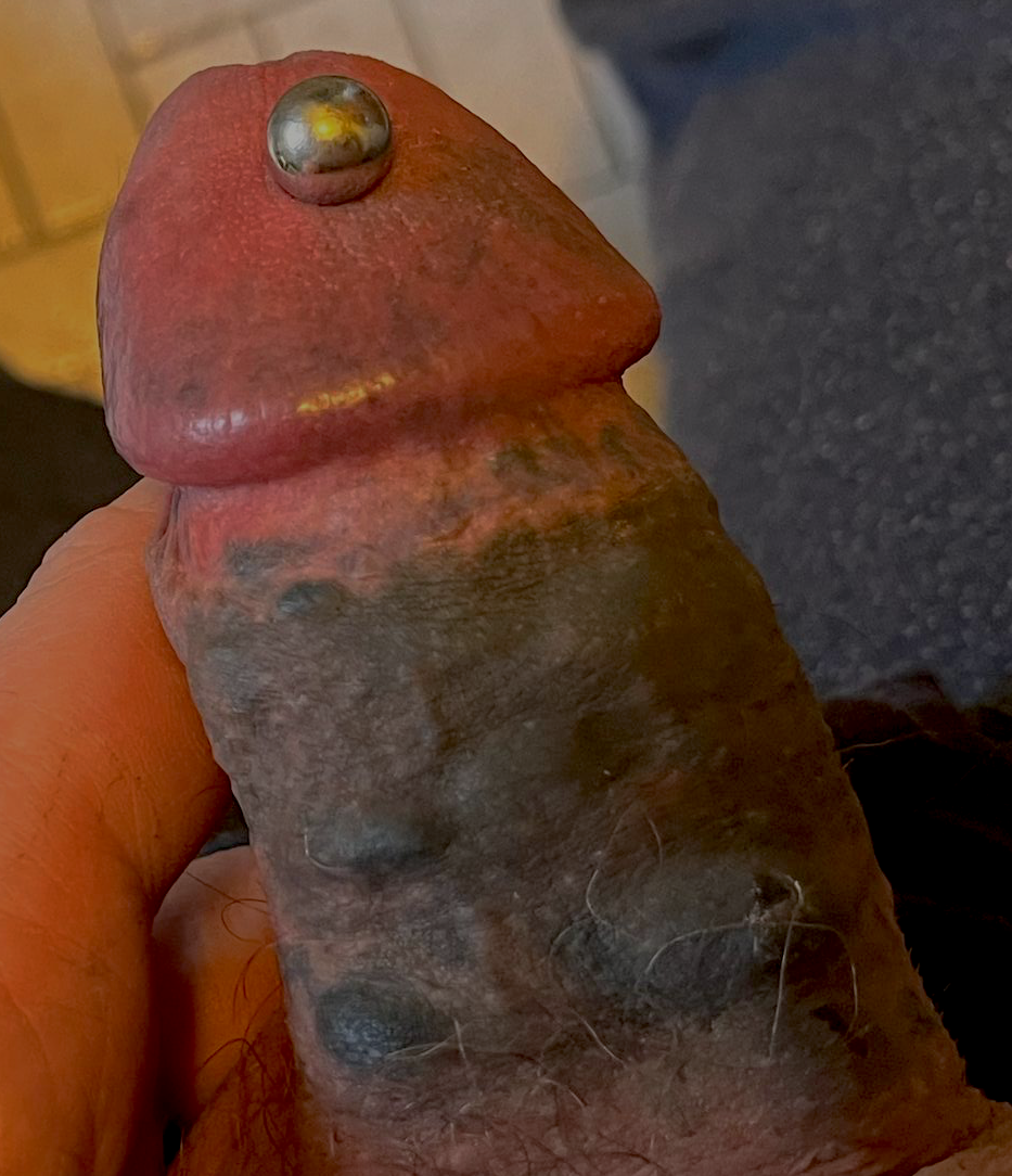 DIY Apadravya @3,0mm & DIY Blackout Dick Tattoo in progress