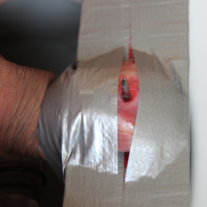 2. Step Fixing 2010-11 Pic 3