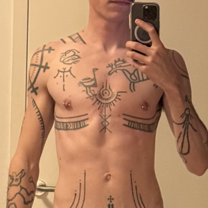 before pec filler