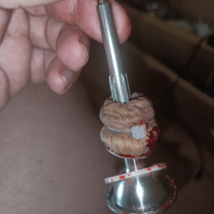 My forskin after being cut off pic 7