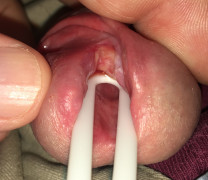 Open wide so everyone can see!
