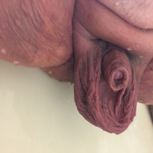 Dick and balls 8 years later