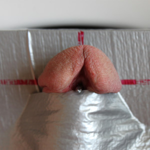 2. Step Fixing 2010-11 Pic 2