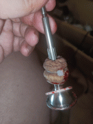 My forskin after being cut off pic 7