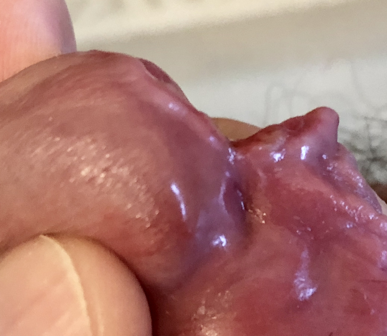 Getting there! I targeted to cut down the the dimple below, marking the edge of my glans before the penis. 