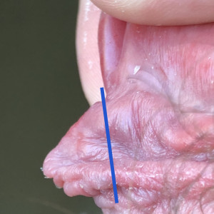 Depiction of how I think I’d like to trim the extra flap from the frenun, likely with tie method too. 