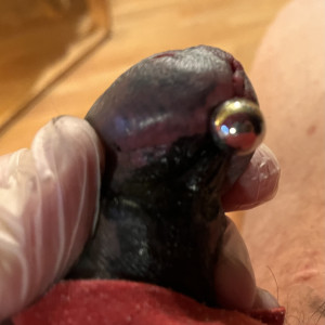 i tried to get the area aound the frenulum blacked out 