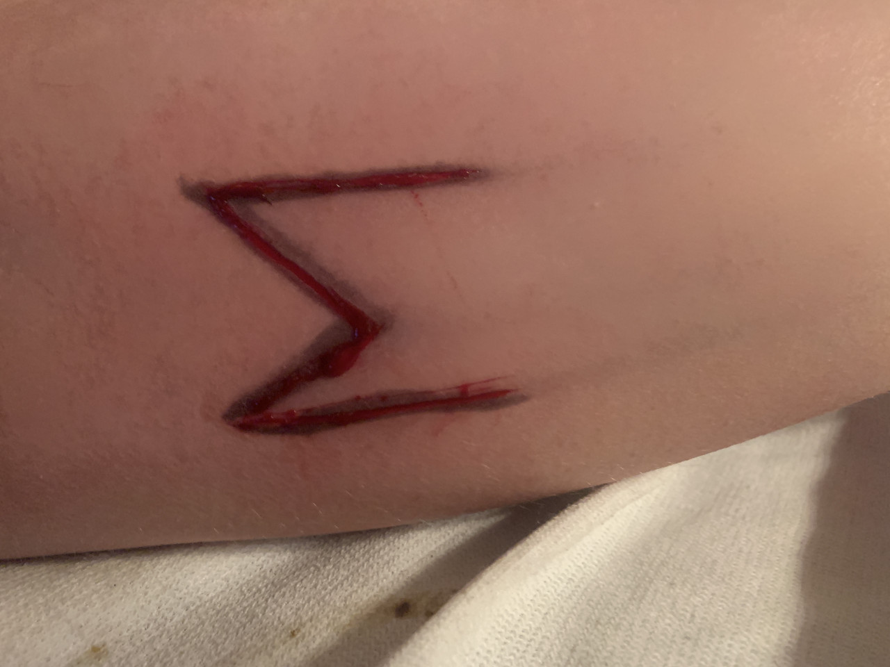 Scarification 