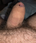 Glansectomy