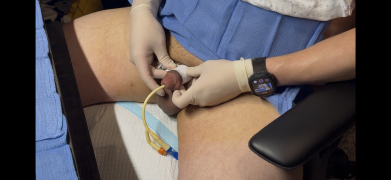 Measuring Penis After Torture