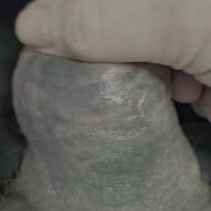 Flaccid girth