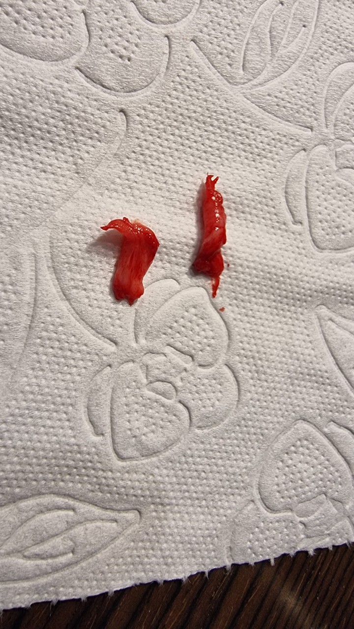 More testicle bits